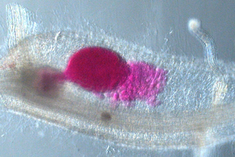 Pink stained female nematode with egg mass in plant root