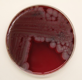 Bacillus spp.
