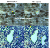Detailed view of an histology slide before and after Laser Capture Microdissection