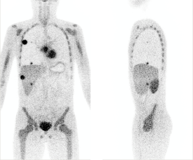 Figure 1: Example of reconstructed PET image by the QETIR software