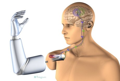 Figure 1: Example of a BCI application