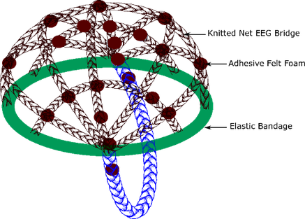 Figure 1 b) schematic illustration of a knitted EEG electrode bridge