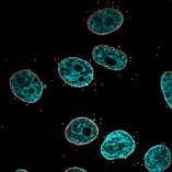 Nucleus (cyan - DAPI staining) with anti-lamine A/C staining (red) and gold nanoparticles (yellow - 70 nm). 