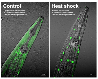 Nuclear relocation of a DAF-16::GFP reporter in C. elegans upon heat shock.