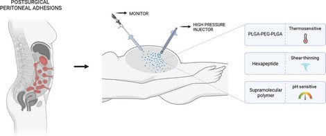 Smart hydrogels delivered by high pressure aerosolization can prevent peritoneal adhesions